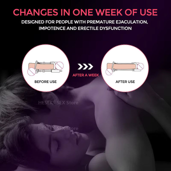 Male Traction Device for Enhancement and Support